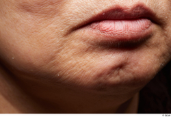 Face Mouth Cheek Skin Woman Asian Scar Chubby Wrinkles Studio photo references